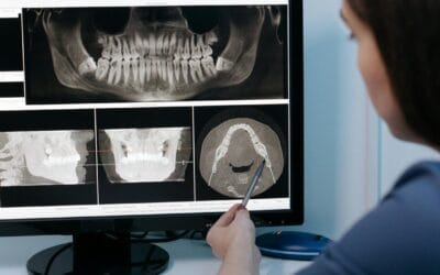 Plano odontológico para empresas: por que seu negócio precisa investir nesse benefício