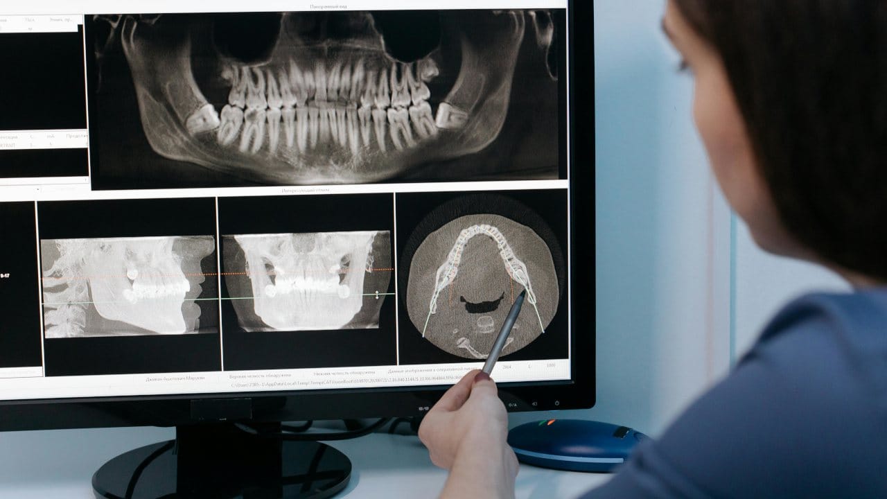 04 – plano odontologico 04 - plano odontologico