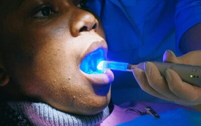 Plano odontológico sem carência e com cobertura 24h. Veja como contratar