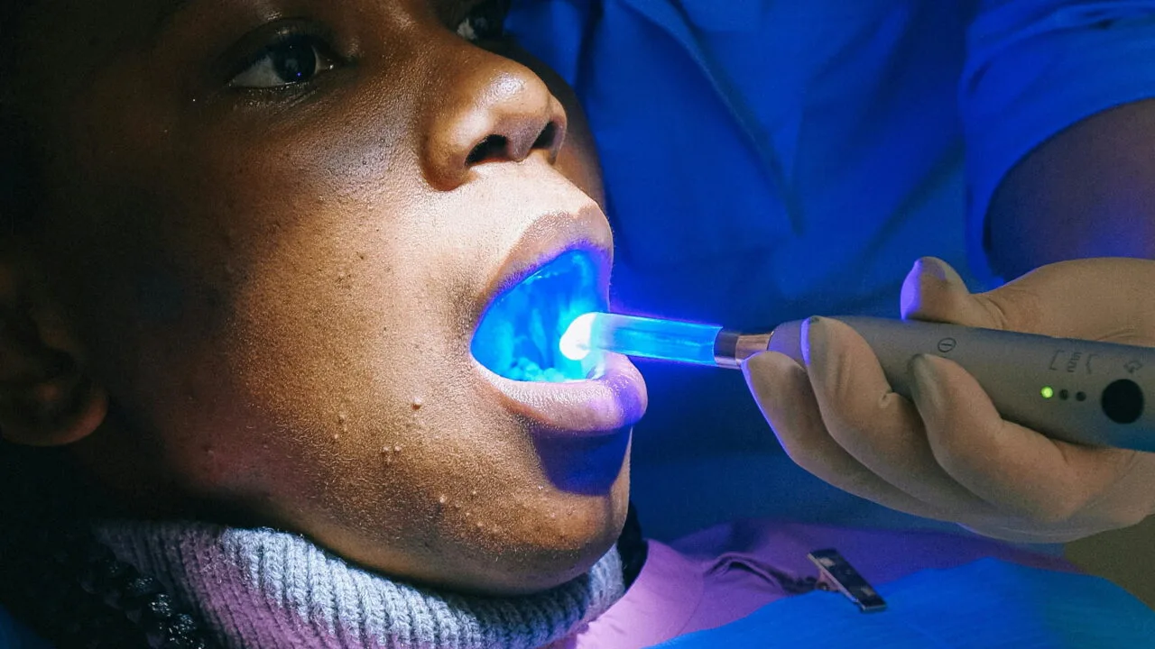 1280x720 - plano odontologico - pexels-shvetsa-3845713