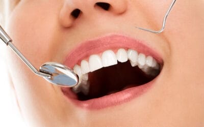 Plano dental individual: Contrate sem sair de casa