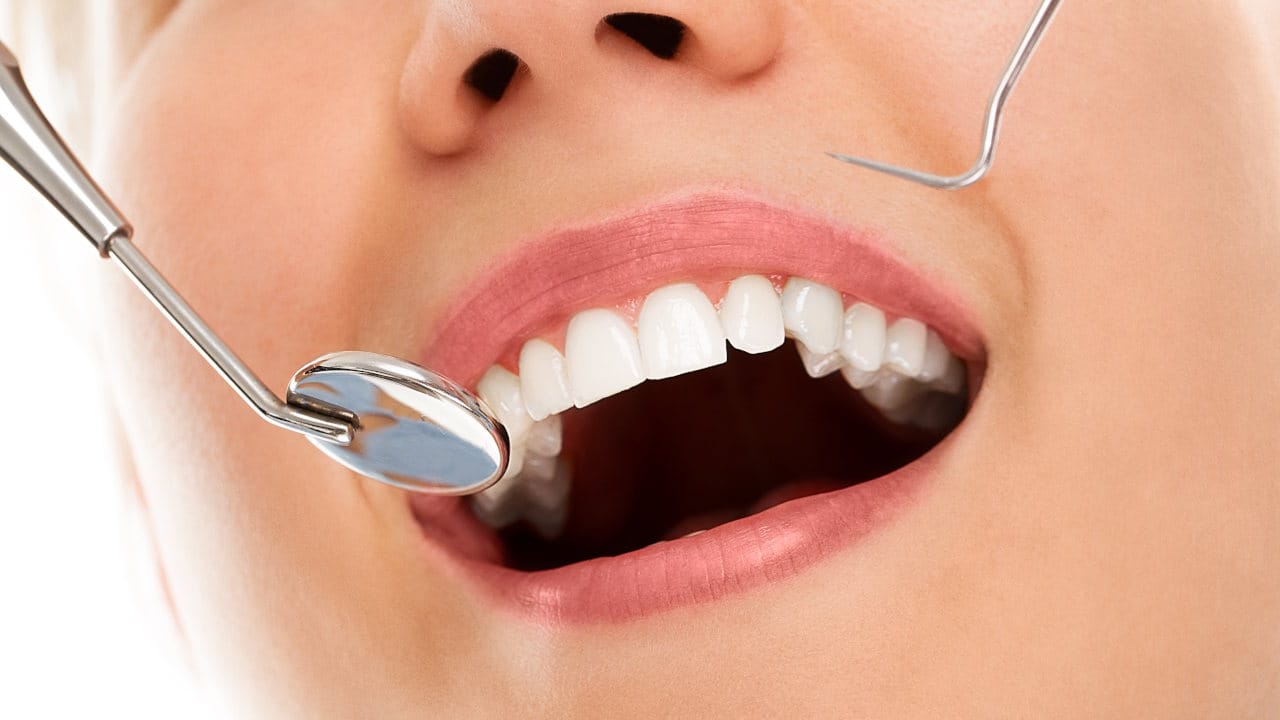 amigaosaude - blog - plano dental individual - 1280x720