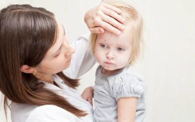 Conheça 7 doenças comuns na infância e as formas de tratá-las