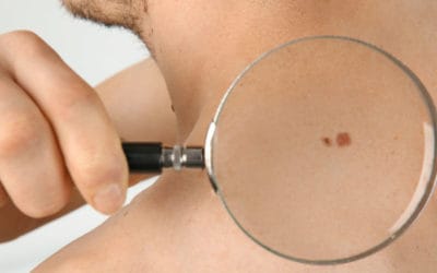 Dezembro Laranja: conheça os tipos de câncer de pele e como evitá-los