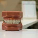Plano dental para pequenas empresas: a corretora Amigão Saúde direciona você para a melhor escolha