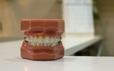 Plano dental para pequenas empresas: a corretora Amigão Saúde direciona você para a melhor escolha